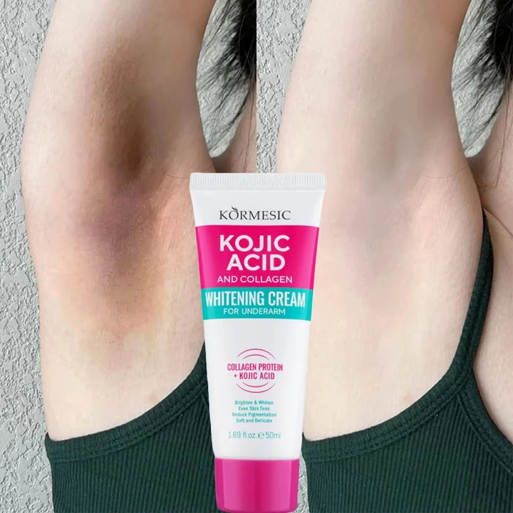 Body Whitening Lotion Dark Spot Remover For Underarms Knees Elbows Melanin Bleaching Lightening Skin Moisturizing Cream