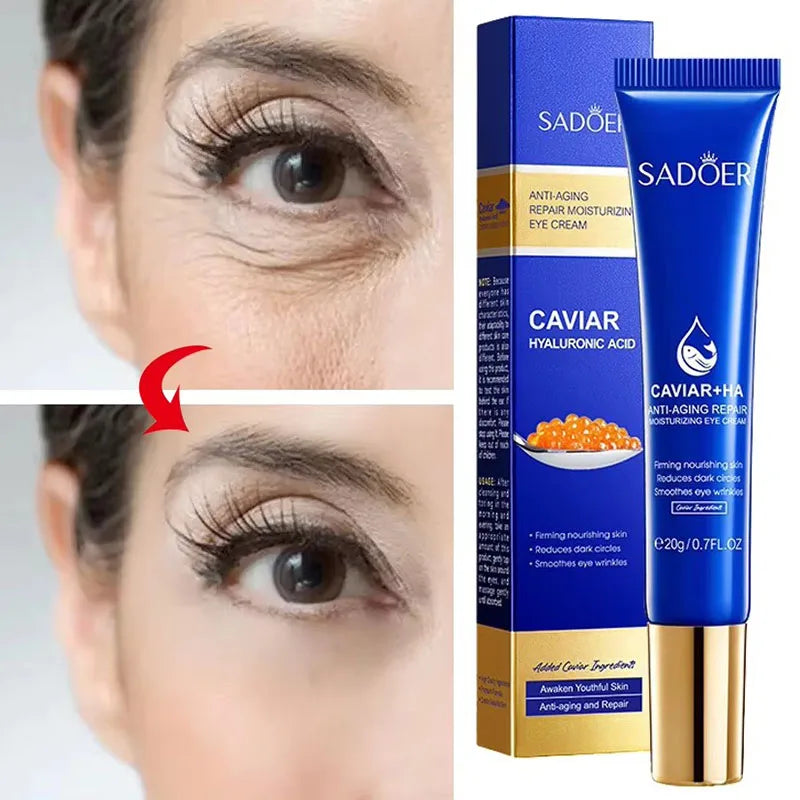Caviar Eye Bag Removal Cream Hyaluronic Acid Anti-Wrinkle Firming Skin Fade Fine Lines Anti Dark Circle Puffiness Eye Care 20g