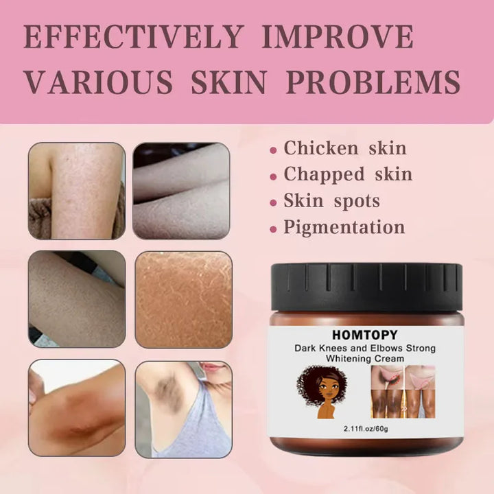 Whitening Cream Private Parts Underarm Bleaching Serum Whiten Butt Knee Brighten Inner Thigh Intimate Parts Dark Remove Melanin