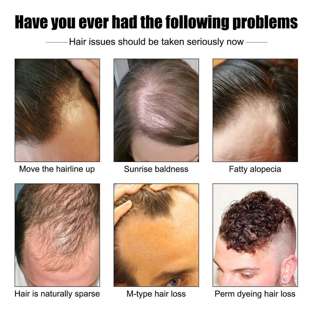 Vitamin E Hair Growth Oil Prevent Baldness Repair Damaged Strengthen Roots Improving Loss Reduce Frizz Men Hair Essential Serum