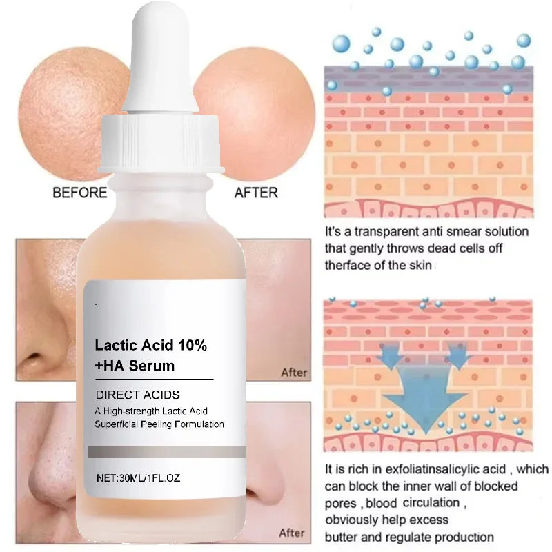 Large Pore essence Lactic Acid Facial Pore Shrinking Product Pore Firming and Smooth Korean Skin Care