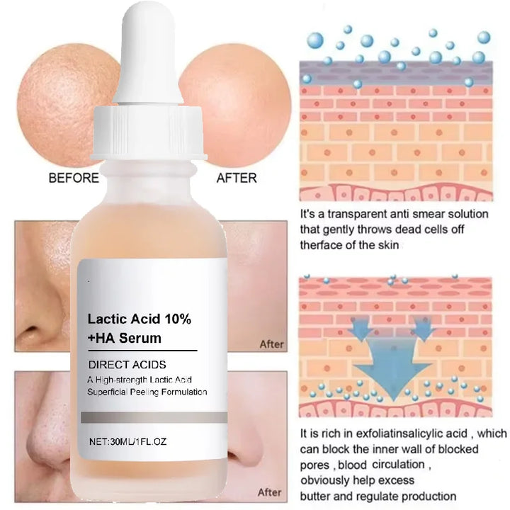 Large Pore essence Lactic Acid Facial Pore Shrinking Product Pore Firming and Smooth Korean Skin Care